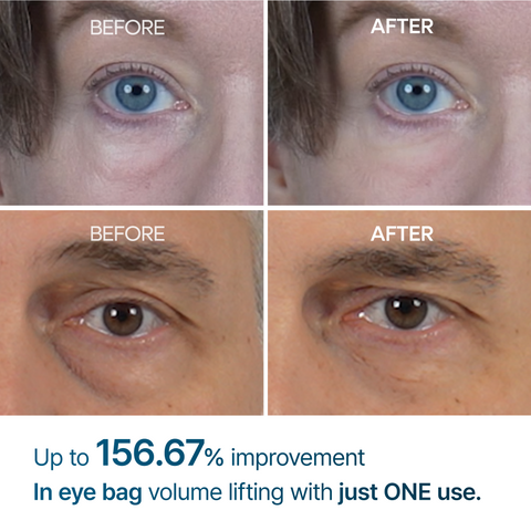 Dr Melaxin Eyephalt Eyecream